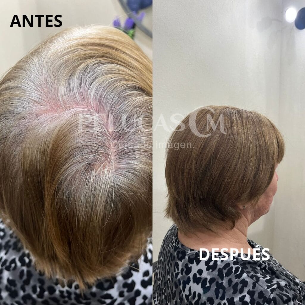 toppers de pelo natural